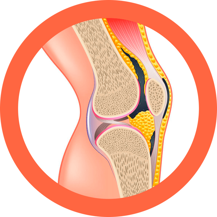 Hondroten - atjauno locītavas un muskuļus