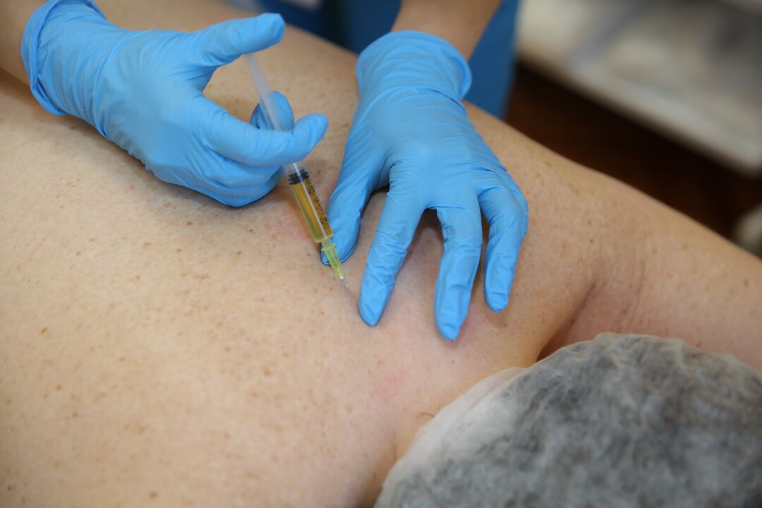 hondroprotektoru injekcijas mugurai