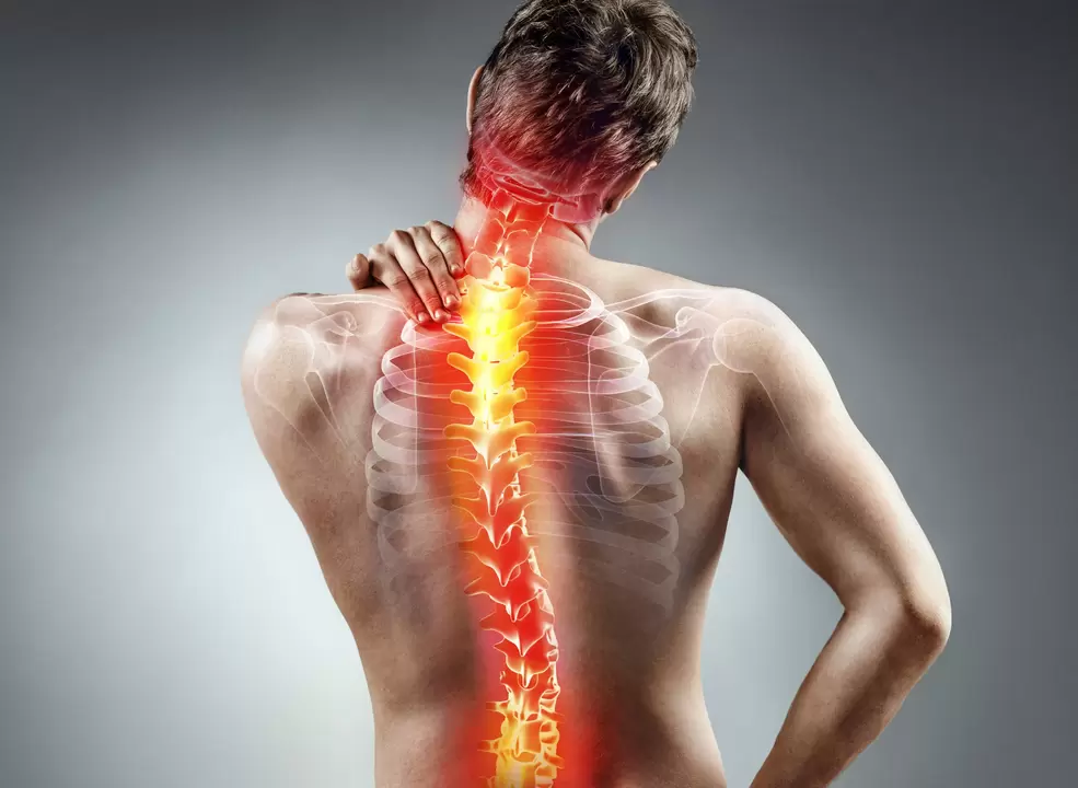 mugurkaula osteohondroze